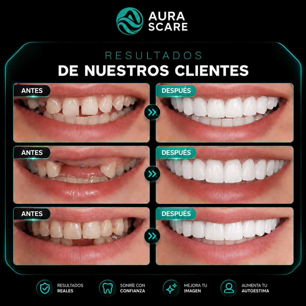 🩵VUELVE A SONREIR CON CONFIANZA✨ 2X1 +Envío Gratis🏡🚚